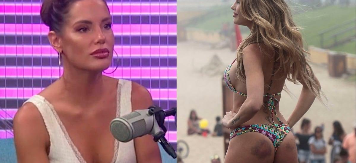 “Me daba vergüenza contarlo”: nueve años después Gala revela la verdad tras los grandes moretones que mostró en la candidatura a Reina de Viña 2017