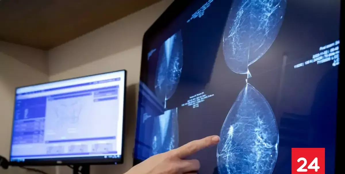 Cáncer de mama: la IA revela lo invisible para los médicos