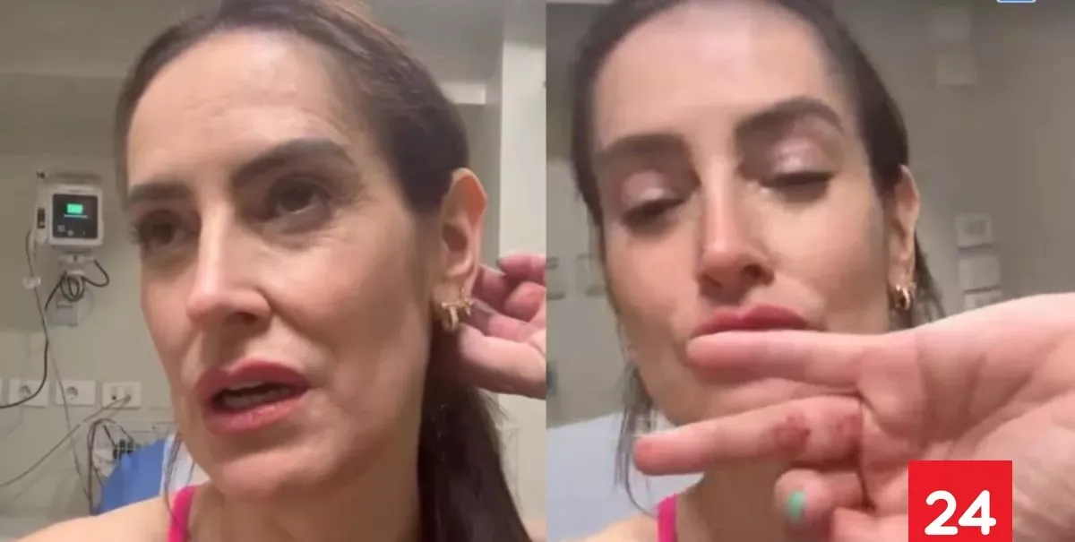 "Logré quitar una pistola": Adriana Barrientos entrega detalles del violento portonazo sufrido en Las Condes