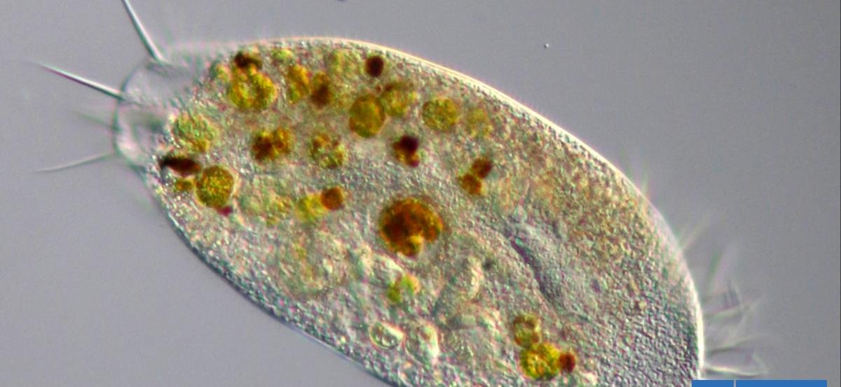 Una "amenaza creciente": las amebas peligrosas se están propagando por el mundo, advierten científicos