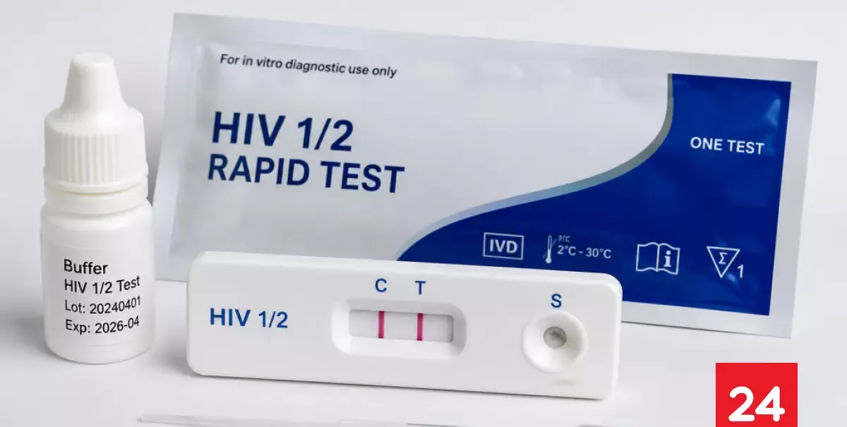 “Abstenerse de adquirir y utilizar”: ISP alerta por test rápidos de VIH sin registro sanitario en Chile