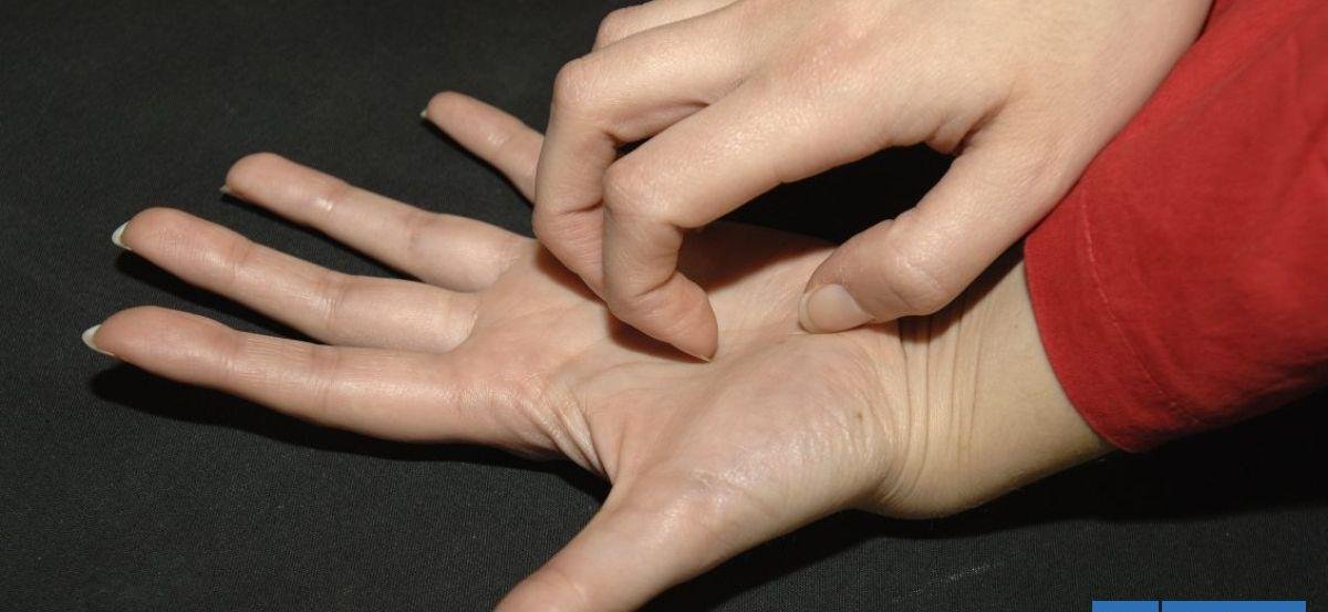 Tras brote en Antofagasta: ¿Qué es la sarna Noruega, cómo se contagia y cuáles son sus síntomas?