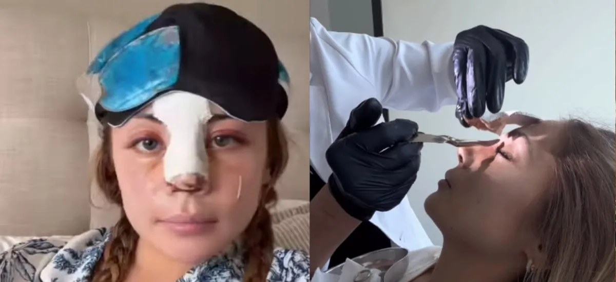 Skarleth Labra mostró su antes y después tras someterse a operación estética