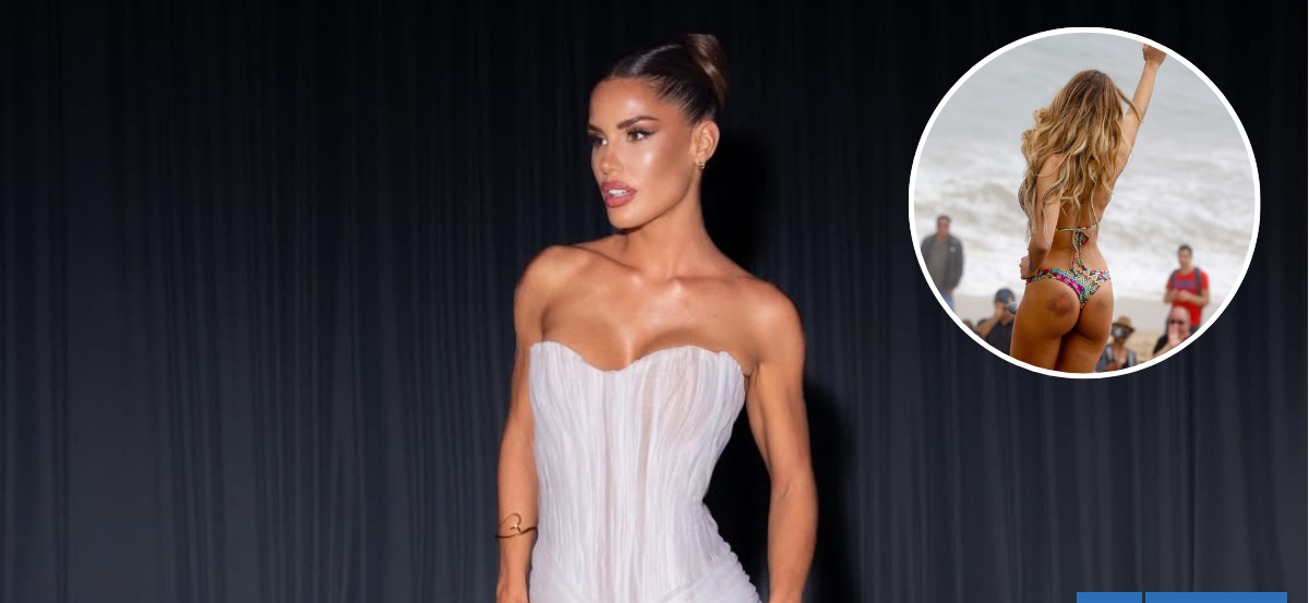 A casi 10 años: Gala Caldirola reveló la verdad de sus moretones cuando fue candidata a Reina de Viña