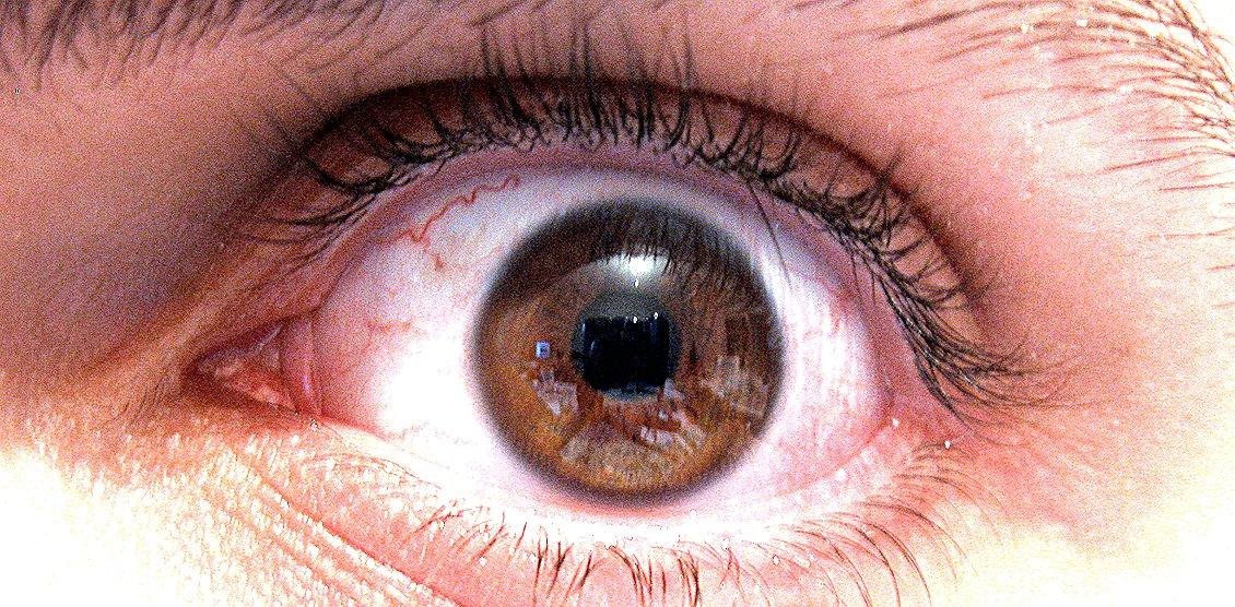 Descubren el patrón genético de la manía, clave para dar con nuevos tratamientos