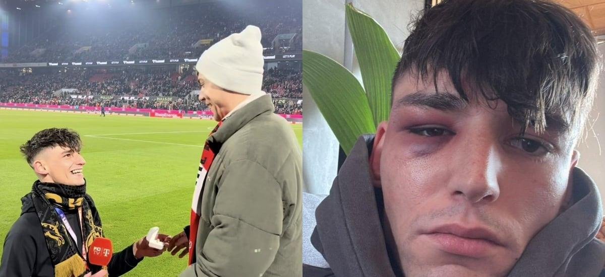 Ataque homófobo sacude a Alemania: árbitro fue agredido tras pedirle matrimonio a su pareja en un partido