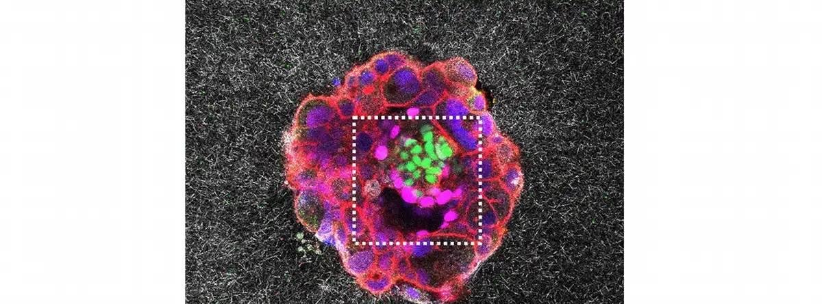 Hito: científicos logran filmar por primera vez la implantación de un embrión humano en el útero