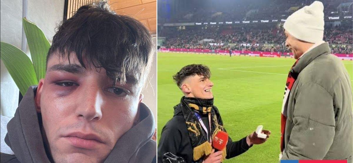 Árbitro alemán sufre brutal ataque homófobo tras pedir matrimonio a su novio en duelo de la Bundesliga