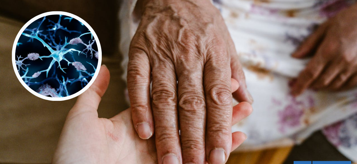 Por qué las personas con cáncer rara vez tienen Alzheimer: estudio habría dilucidado misterio médico