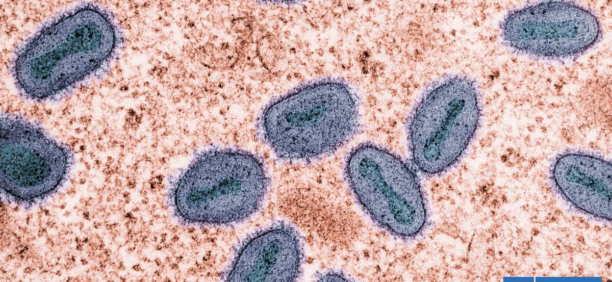 Experto en enfermedades infecciosas revela cuáles son los 3 virus que podrían causar crisis en 2026