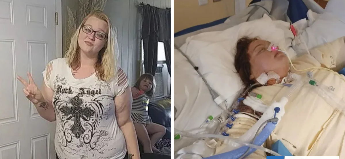 Mujer terminó quemada y en coma por salvar a la hermana de su cita en EEUU: él la ignoró para siempre