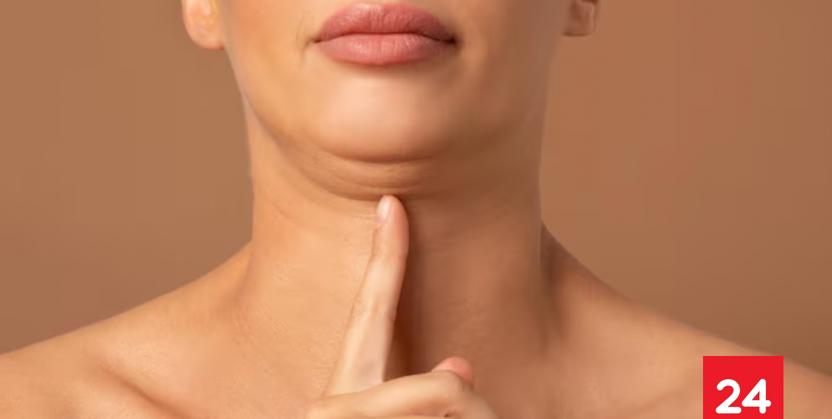 ¿Tienes papada?: Influencer enseña cómo eliminarla en solo días y sin cirugía